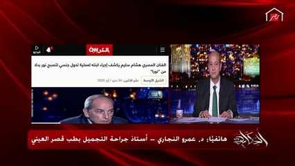 طبيب يرد على سؤال عمرو أديب: كيف يتم تحويل الأنثى بأعضاءها الأنثوية وصدرها لذكر بجهازه التناسلي؟