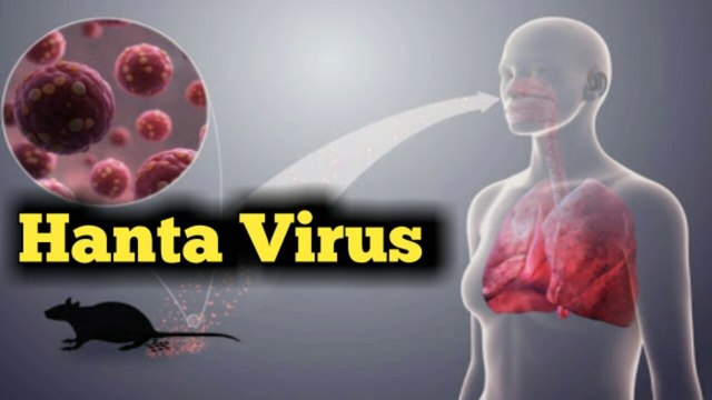 Hanta Virus || Hanta virus symptoms, effects and prevention || hantavirus is epidemic || Hantavirus medicine|| Hantavirus vaccine || symptoms of hantavirus || hantavirus in bengali || hanta virus in china || pin global universe || hantavirus treatment
