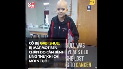 Phép màu y học đã giúp cô bé cụt chân vẫn có thể múa ba lê