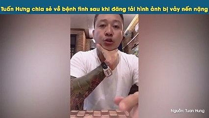 Tuấn Hưng chia sẻ về bệnh tình sau khi đăng tải hình ảnh bị vảy nến nặng
