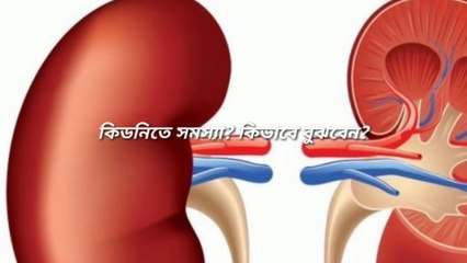 কিডনি রোগের লক্ষণ। কিডনি সমস্যা কিভাবে বুঝবেন? কিডনি সমস্যার প্রাথমিক ১৪ টি লক্ষণ