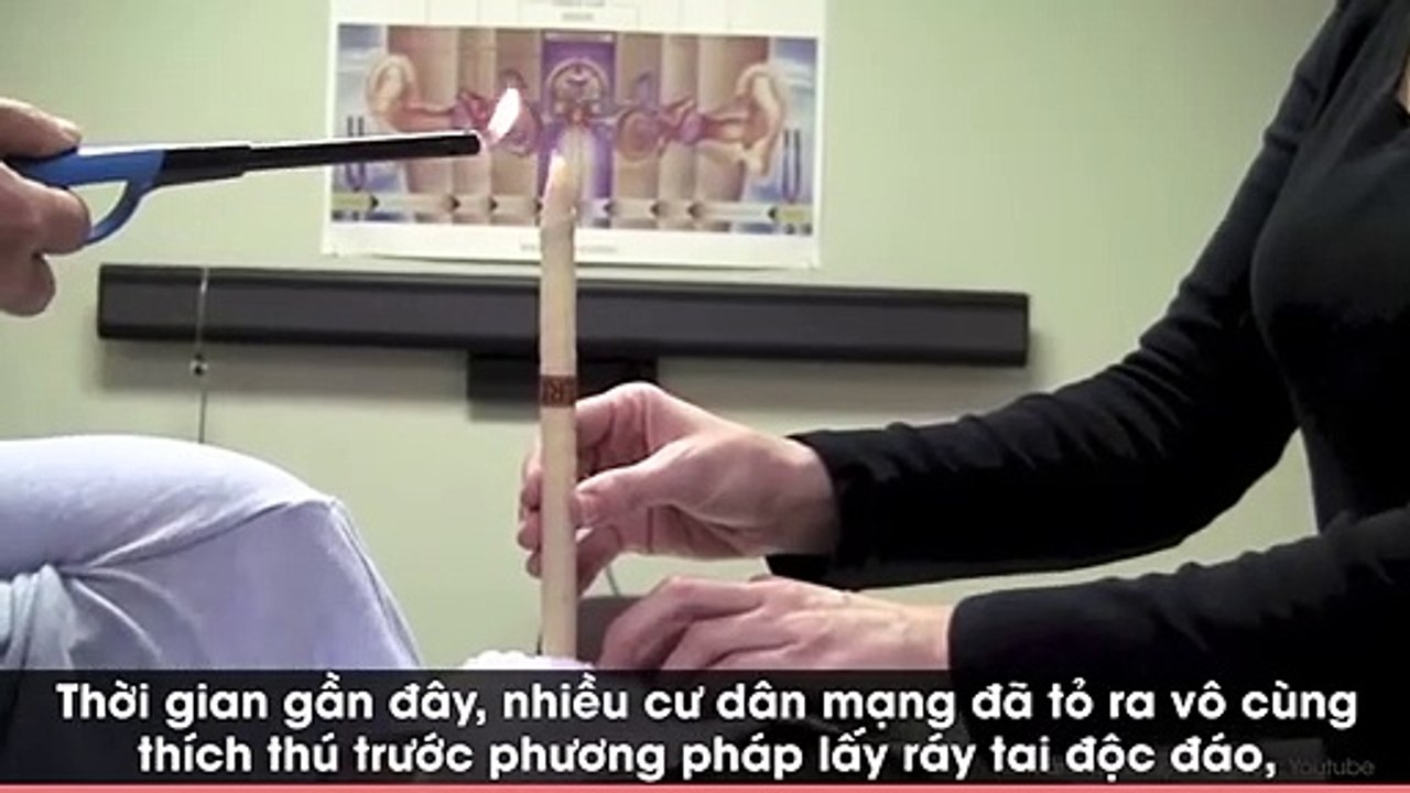 Sự thật đằng sau phương pháp lấy ráy tai được cho là an toàn nhất thế giới