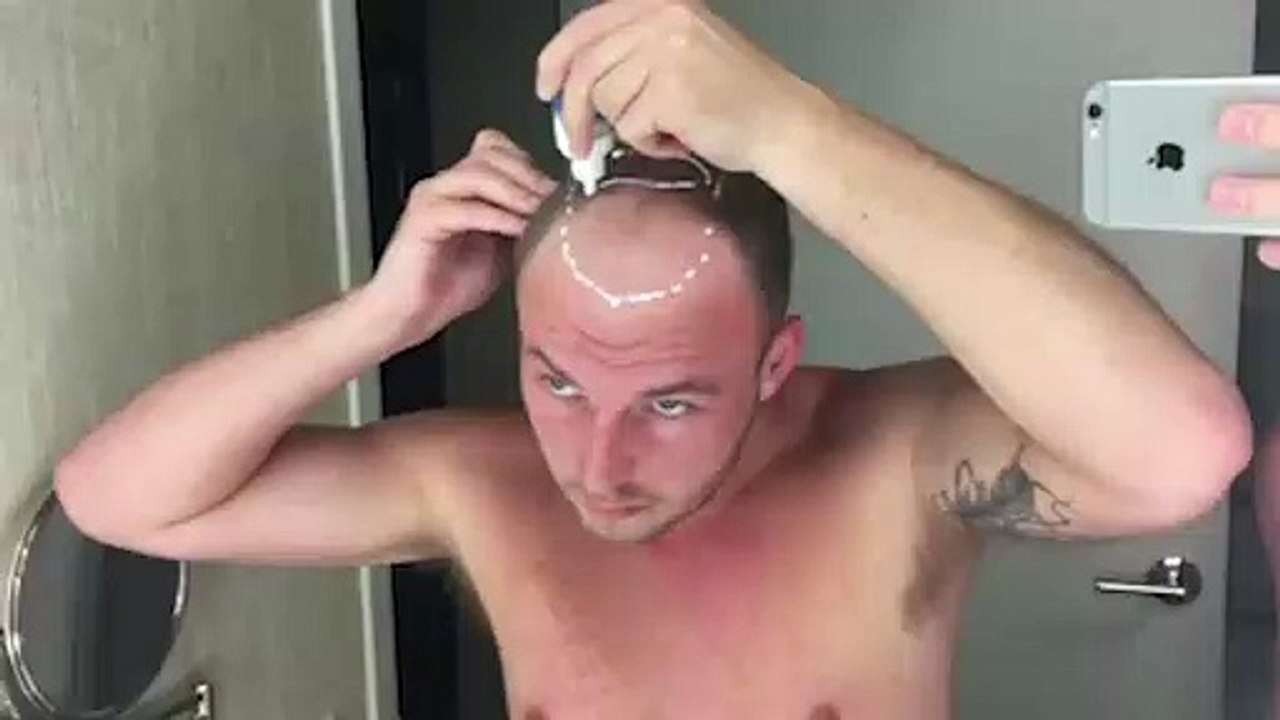 Đập tan nỗi lo sợ hói đầu với sản phẩm tóc giả “đẹp hơn cả tóc thật”