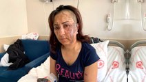 3 çocuk annesi kadın, boşanmak istediği eşinin kezzaplı saldırısına uğradı