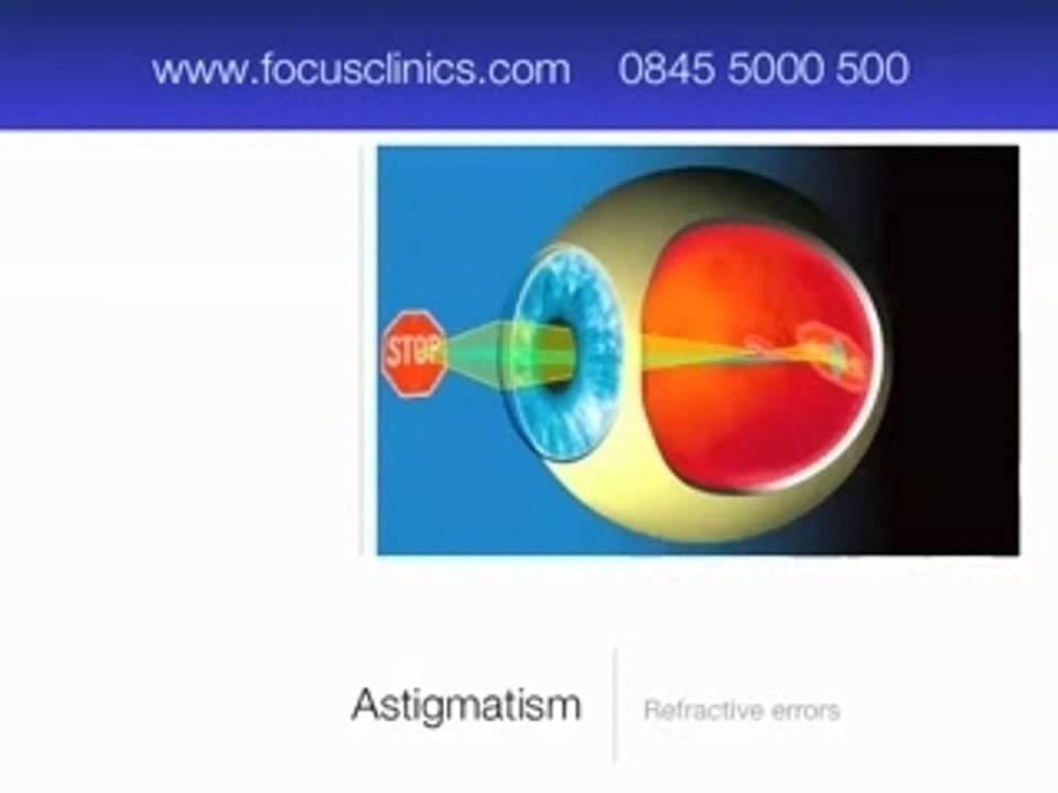 Vision problems and needing glasses