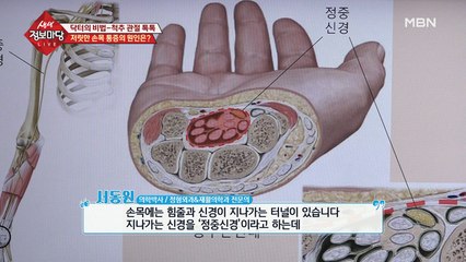 저릿한 손목 통증의 원인은?