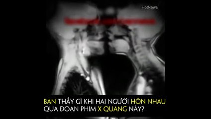 Bạn thấy gì khi hai người hôn nhau qua đoạn phim X quang này?