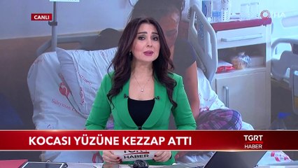 Kocası Yüzüne Kezzap Attı