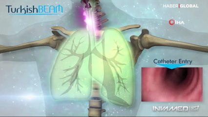 Koronavirüs ile mücadelede Türk ışını dönemi resmen başladı