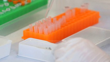 Top News - Studiuesit: Koronavirusi sulmon jo vetëm mushkëritë, por edhe zemrën, nervat, trurin dhe…