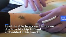 Will microchip implants be the next big thing in Europe?