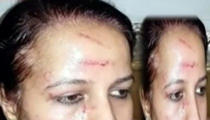 Descargar video: Lady doctor thrashed in Haridwar hospital