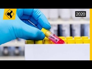 1,511 te prekur me Covid ne Maqedonine e Veriut | Lajme-News