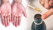 हाथों को मुलायम रखने के लिए बस करें ये 7 काम | 7 Effective Home Remedies for dry Hands | Boldsky