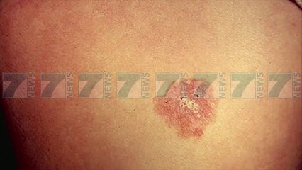 KUJDES NGA KANCERI I LEKURES, MJEKET «KA VDEKSHMERI TE LARTE» - News, Lajme - Kanali 7