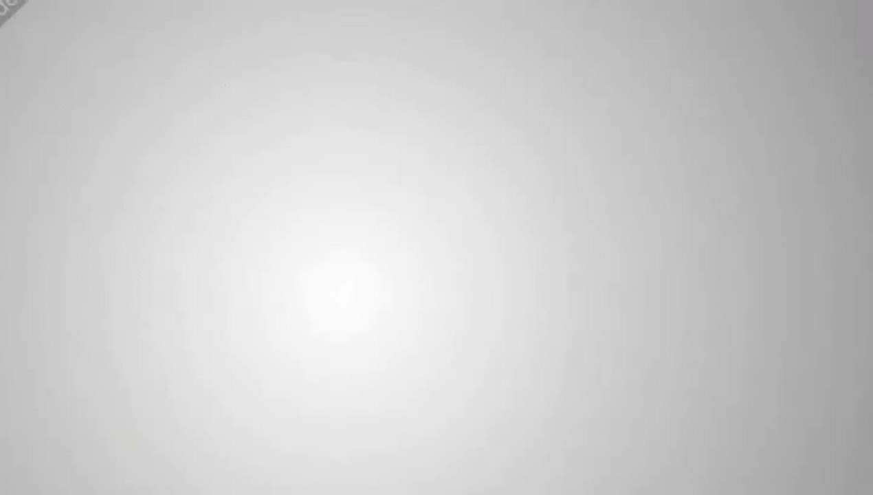 Stress| Symptoms And Causes Of Stress| Physical And Mental Effects Of Stress|