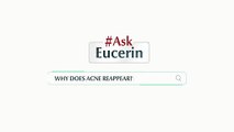 Eucerin ProACNE Solution- Prevents Acne Reappearance