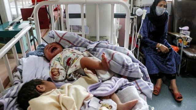 Kabil'de doğum hastanesine saldırı: İki anne doğum yaparken vuruldu, bir anne bebeğini kuvöze...