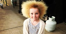 Cette fillette atteinte du syndrome des cheveux incoiffables ressemble à une poupée troll