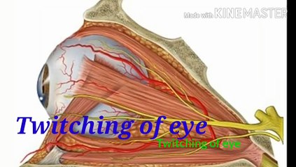 Twitching of eyes