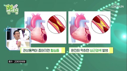 (심각) 고혈압 유전적 성향 ↑ 꾸준한 관리 必