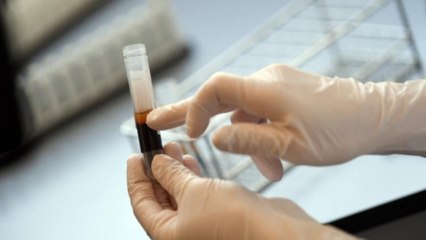 China may have 8 times more coronavirus cases than official numbers