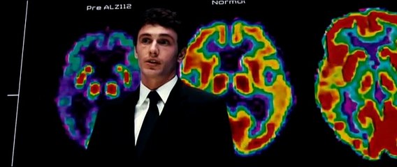 El origen del planeta de los simios - Tráiler español