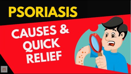 This Bad Habit Causes Psoriasis | Quick Psoriasis Relief