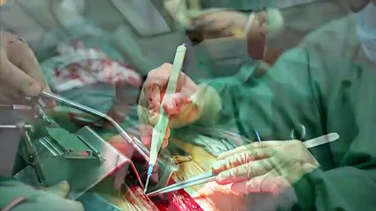 Chinese Organ Harvesting - The Dragon Awakes!