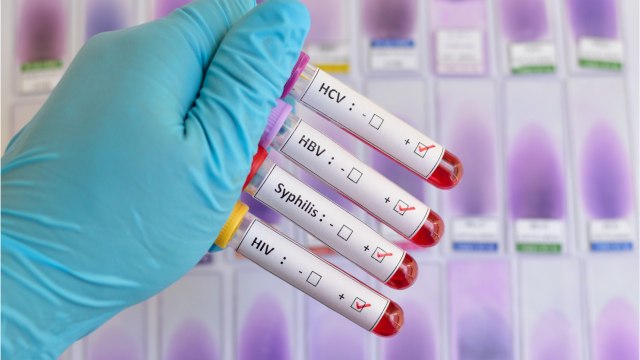 STD Rise During Coronavirus Pandemic