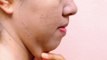 Double Chin को कम करने के उपाय | Effective solution to get rid of Double Chin | Boldsky