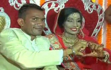 Speed News: Wrong Number: How An Acid Attack Survivor Found Love