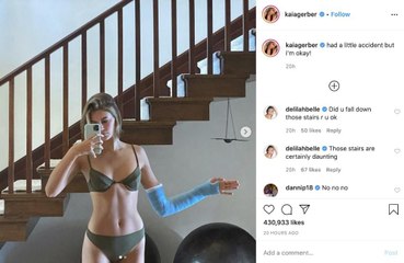 カイア・ガーバー、手首を骨折