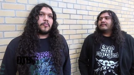 Skeletal Remains - FIRST CONCERT EVER Ep. 241