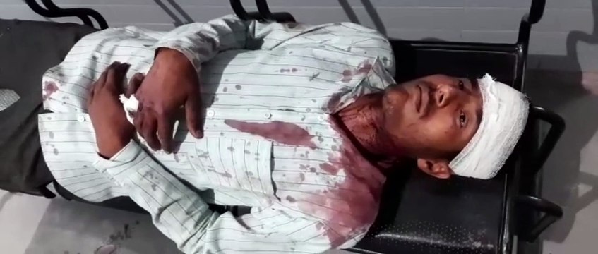 शामली: दो पक्षों में खूनी संघर्ष, आधा दर्जन से ज्यादा घायल, पुलिस जांच में जुटी