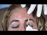 Botox for the Forehead Demonstration & Botox and Dermal Filler Certification Guarantee