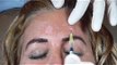 Botox for the Forehead Demonstration & Botox and Dermal Filler Certification Guarantee