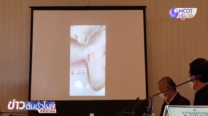 วันนี้เริ่มทดลองวัคซีนโควิด-19 ชนิด mRNA เข็มแรกในลิง