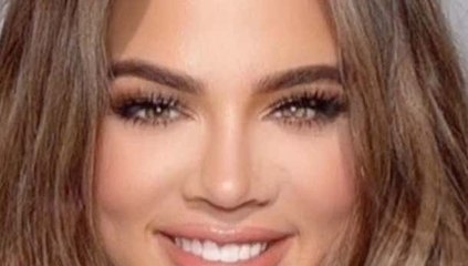 Khloe Kardashian's New Face Proves Anyone Can Be Hot With Enough Money