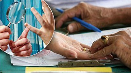 किस्मत बदलने के लिए लोग यहाँ कर रहेे है अजीब काम । Hand surgery to change their luck । Boldsky