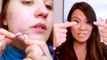 How to pop a pimple yourself, according to Dr. Pimple Popper's tips