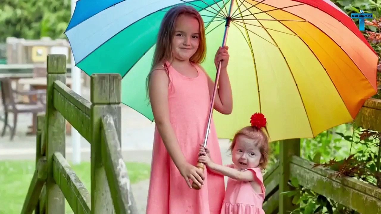 Top 10 Most Unusual And Unique People With Unique Features To Ever Exist