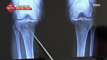 주인공은 편안히 걸을 수 있을까?