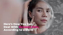 Here’s How You Can Deal With Stressed Skin, According to a Derm