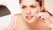 सिर्फ 2 मिनट में अपर लिंप्स के बाल कैसे हटाएं | Upper lips hair removal | Boldsky