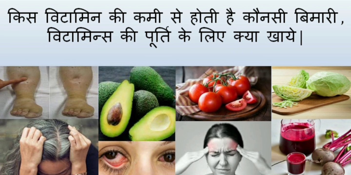 All about Vitamins | Deficiency of vitamins | Sources of Vitamins