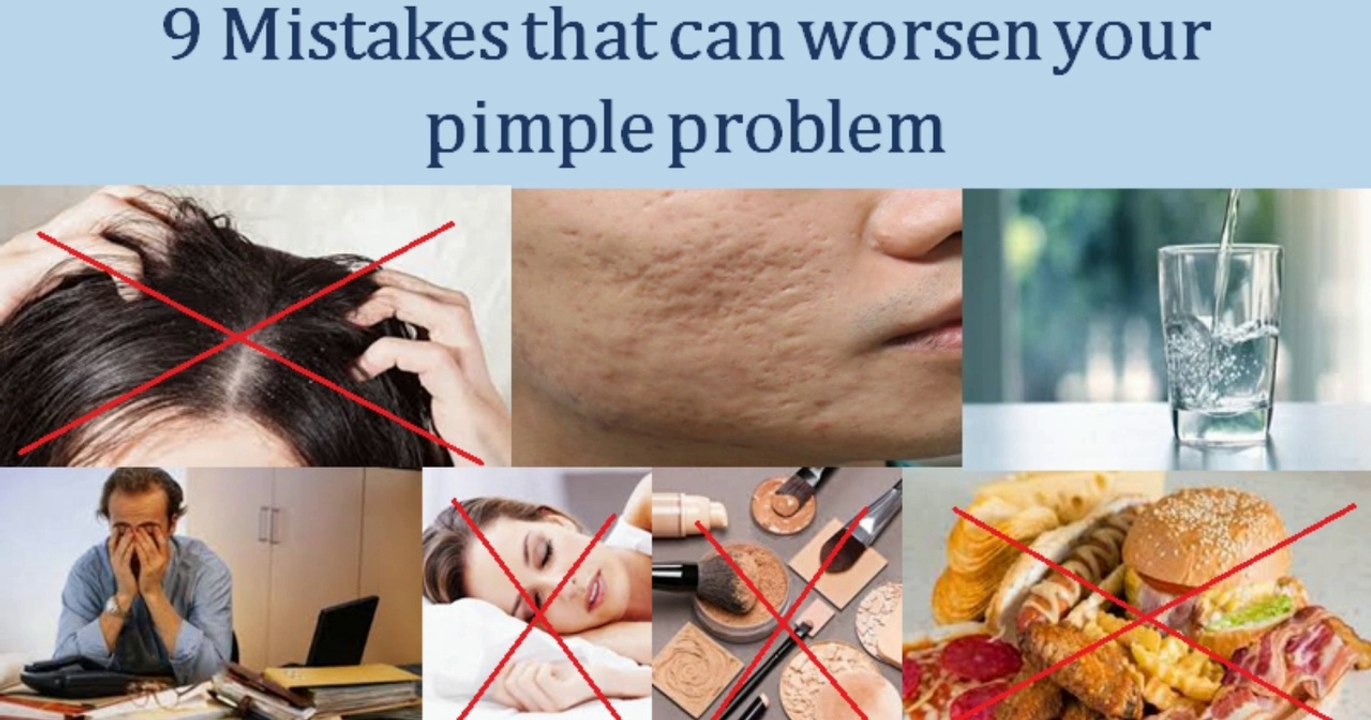 9 mistakes that can worsen your pimple problem.