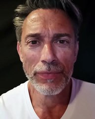 Gérard Vives accusé d'avoir eu recours à la chirurgie esthétique, il répond