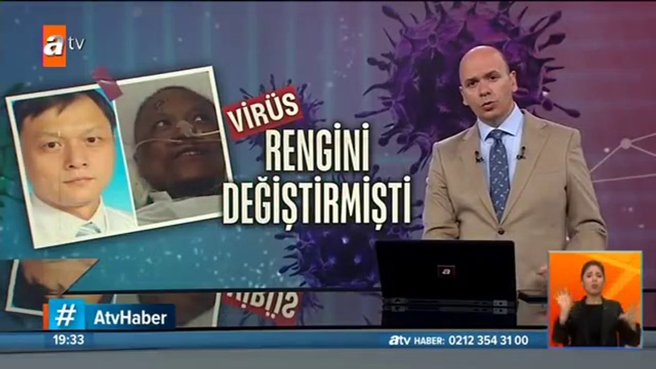 Koronavirüs nedeniyle ten rengi değişen Çinli doktor hayatını kaybetti