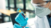 Prof. Dr. Tükek: Covid antikor testlerinin hepsi güvenilir değil
